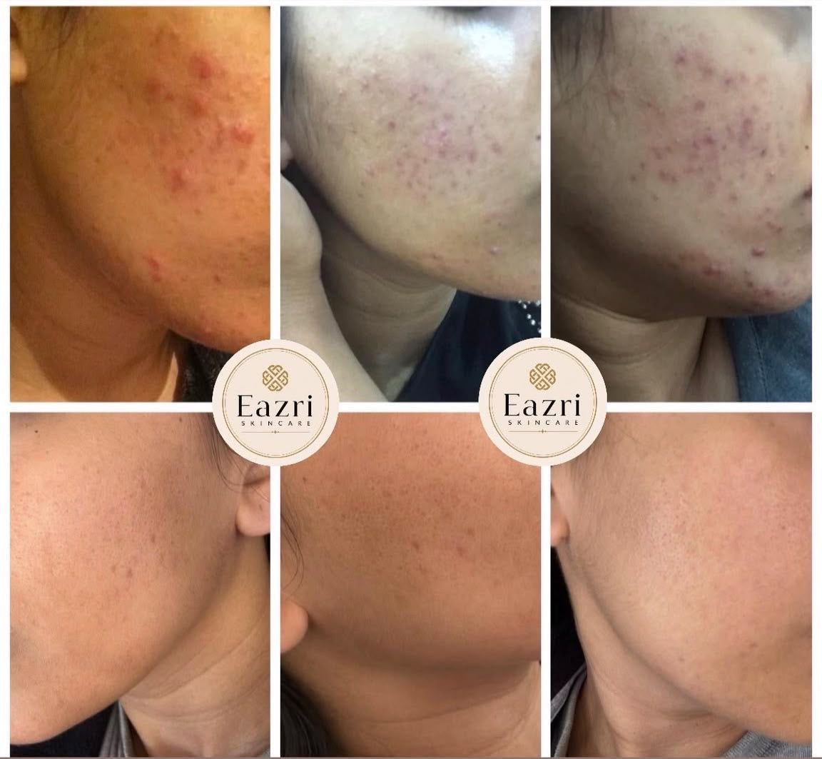 Before & After