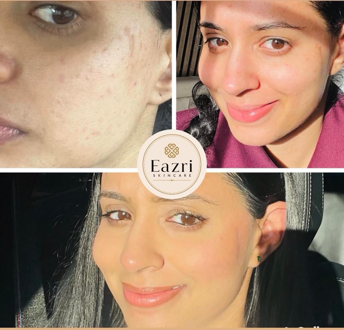 Clearer-Looking Skin