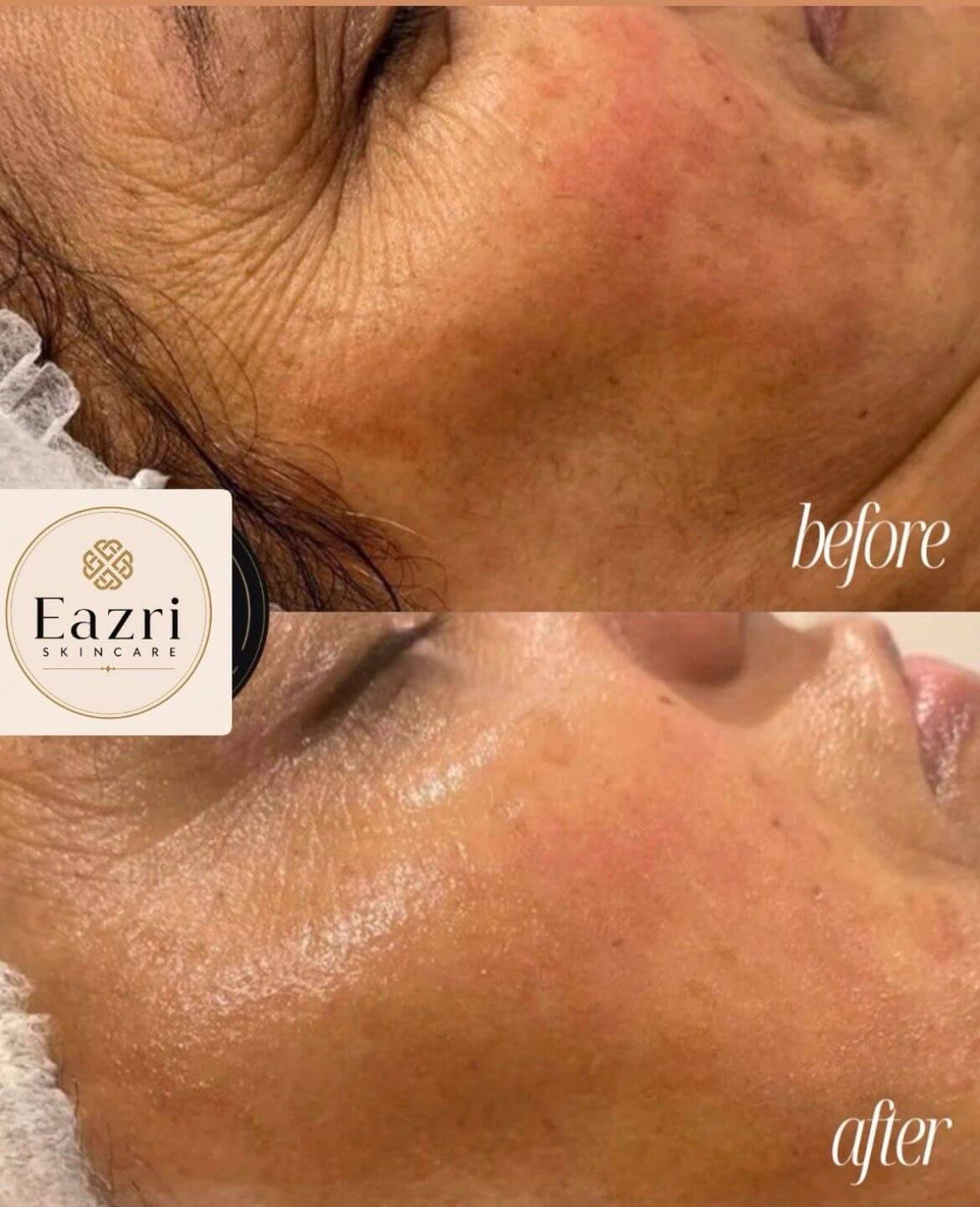 Clearer, Calmer Skin